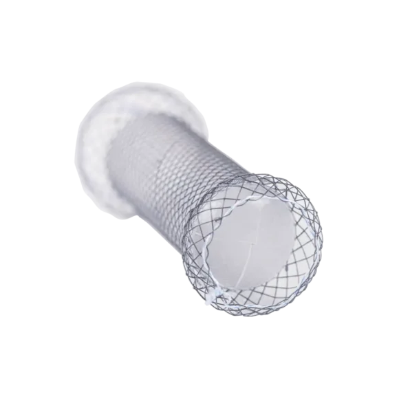 anti reflux esophageal stents 1 580x580
