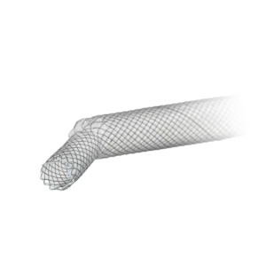 J-Shape Tracheal Stents