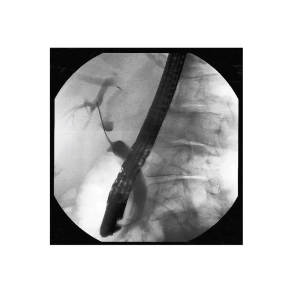 non vascular sterile hydro slide guidewire 2 580x580