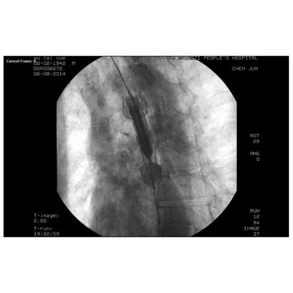non vascular sterile hydro slide guidewire 3 580x580