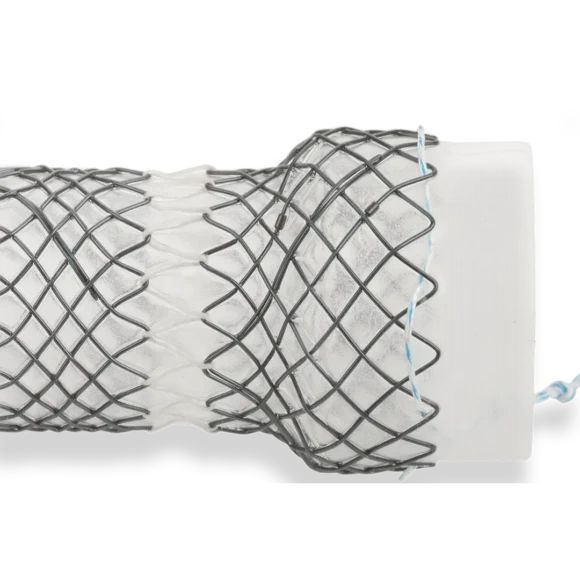 segmented stents 1 1 580x580