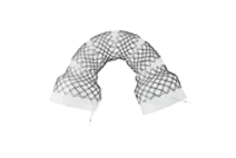 segmented stents