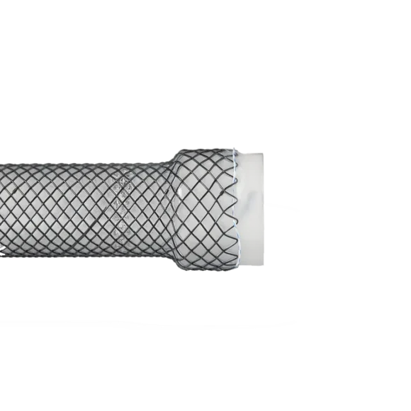 softcup esophageal stents 1 1 580x580