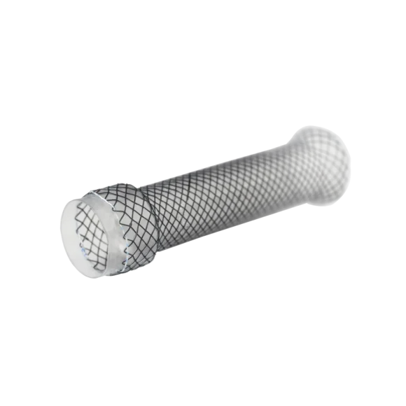 softcup esophageal stents 580x580